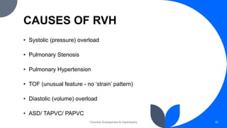 CAUSES OF RVH
• Systolic (pressure) overload
• Pulmonary Stenosis
• Pulmonary Hypertension
• TOF (unusual feature - no ‘strain’ pattern)
• Diastolic (volume) overload
• ASD/ TAPVC/ PAPVC
Chamber Enlargement & Hypertrophy 45
 