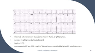 • In lead V1 -tall monophasic R wave or a diphasic RS, Rs, or qR Compleex.
• Inversion in right precordial leads ('strain)
• S pattern in V6
• In pure valvular PS, age 2-20, height of R wave in mm multiplied by 5gives RV systolic pressure
Chamber Enlargement & Hypertrophy 46
 