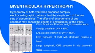BIVENTRICULAR HYPERTROPHY
Hypertrophy of both ventricles produces complex
electrocardiographic patterns. Not the simple sum of the two
sets of abnormalities. The effects of enlargement of one
chamber may cancel the effects of enlargement of the other.
Chamber Enlargement & Hypertrophy 49
• LVH +Prominent R waves in right precordial leads.
• Voltage criteria for LVH + RAD
• LAE as sole criterion for LVH + RVH.
• ECG evidence of LVH with clockwise rotation of
heart.
• Large equiphasic QRS complex in mid precordial
leads.
 