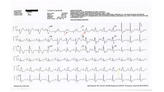 Comprehensive ECG Interpretation in Congenital Heart Disease for ...