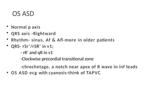 Comprehensive ECG Interpretation in Congenital Heart Disease for ...