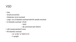 Notched Rv1 Comprehensive ECG Interpretation in Congenital Heart Disease for ...