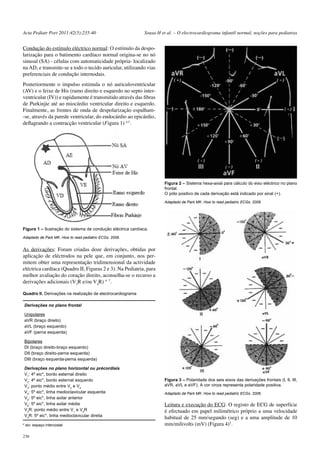 Acta Pediatr Port 2011:42(5):235-40 Sousa H et al. – O electrocardiograma infantil normal, noções para pediatras 
Condução do estímulo eléctrico normal: O estímulo da despo-larização 
236 
para o batimento cardíaco normal origina-se no nó 
sinusal (SA) - células com automaticidade própria- localizado 
na AD, e transmite-se a todo o tecido auricular, utilizando vias 
preferenciais de condução internodais. 
Posteriormente o impulso estimula o nó auriculoventricular 
(AV) e o feixe de His (ramo direito e esquerdo no septo inter-ventricular 
(IV)) e rapidamente é transmitido através das fibras 
de Purkinjie até ao miocárdio ventricular direito e esquerdo. 
Finalmente, as frentes de onda de despolarização espalham- 
-se, através da parede ventricular, do endocárdio ao epicárdio, 
deflagrando a contracção ventricular (Figura 1) 4,5. 
As derivações: Foram criadas doze derivações, obtidas por 
aplicação de eléctrodos na pele que, em conjunto, nos per-mitem 
obter uma representação tridimensional da actividade 
eléctrica cardíaca (Quadro II, Figuras 2 e 3). Na Pediatria, para 
melhor avaliação do coração direito, aconselha-se o recurso a 
derivações adicionais (V3R e/ou V4R) 4- 7. 
Quadro II. Derivações na realização de electrocardiograma 
Derivações no plano frontal 
Unipolares 
aVR (braço direito) 
aVL (braço esquerdo) 
aVF (perna esquerda) 
Bipolares 
DI (braço direito-braço esquerdo) 
DII (braço direito-perna esquerda) 
DIII (braço esquerda-perna esquerda) 
Derivações no plano horizontal ou précordiais 
V1: 4º eic*, bordo esternal direito 
V2: 4º eic*, bordo esternal esquerdo 
V3: ponto médio entre V2 e V4 
V4: 5º eic*, linha medioclavicular esquerda 
V5: 5º eic*, linha axilar anterior 
V6: 5º eic*, linha axilar média 
V3R: ponto médio entre V1 e V4R 
V4R: 5º eic*, linha medioclavicular direita 
* eic: espaço intercostal 
Leitura e execução do ECG: O registo de ECG de superfície 
é efectuado em papel milimétrico próprio a uma velocidade 
habitual de 25 mm/segundo (seg) e a uma amplitude de 10 
mm/milivolts (mV) (Figura 4)5. 
Figura 1 – Ilustração do sistema de condução eléctrica cardíaca. 
Adaptado de Park MK. How to read pediatric ECGs. 2006. 
Figura 2 – Sistema hexa-axial para cálculo do eixo eléctrico no plano 
frontal. 
O pólo positivo de cada derivação está indicado por sinal (+). 
Adaptado de Park MK. How to read pediatric ECGs. 2006. 
Figura 3 – Polaridade dos seis eixos das derivações frontais (I, II, III, 
aVR, aVL e aVF). A cor cinza representa polaridade positiva. 
Adaptado de Park MK. How to read pediatric ECGs. 2006. 
 