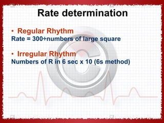 Regular Rythm Engineering ECG In Ischemic Heart Disease - Dr Vivek Baliga Review | PPT