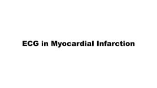 ECG in Myocardial Infarction
 