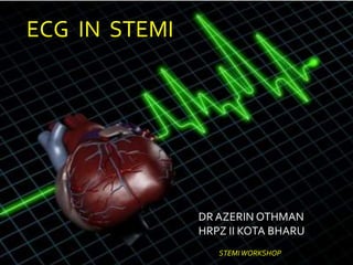 ECG IN STEMI
DR AZERIN OTHMAN
HRPZ II KOTA BHARU
STEMIWORKSHOP
 