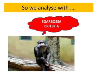So we analyse with ….
SGARBOSSA
CRITERIA
 