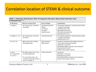 Correlation location of STEMI & clinical outcome
 