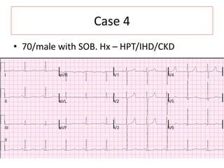 Case 4
• 70/male with SOB. Hx – HPT/IHD/CKD
 