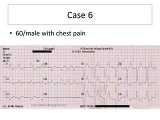 Case 6
• 60/male with chest pain
 