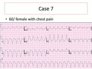 Case 7
• 60/ female with chest pain
 