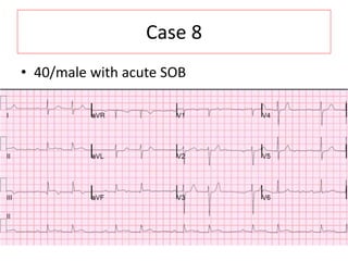Case 8
• 40/male with acute SOB
 