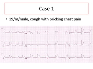 Case 1
• 19/m/male, cough with pricking chest pain
 