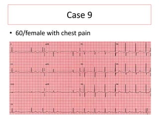 Case 9
• 60/female with chest pain
 