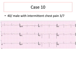 Case 10
• 40/ male with intermittent chest pain 3/7
 