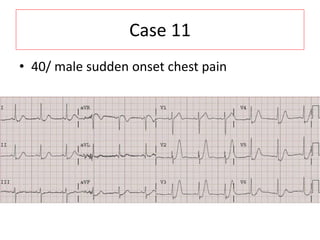 Case 11
• 40/ male sudden onset chest pain
 