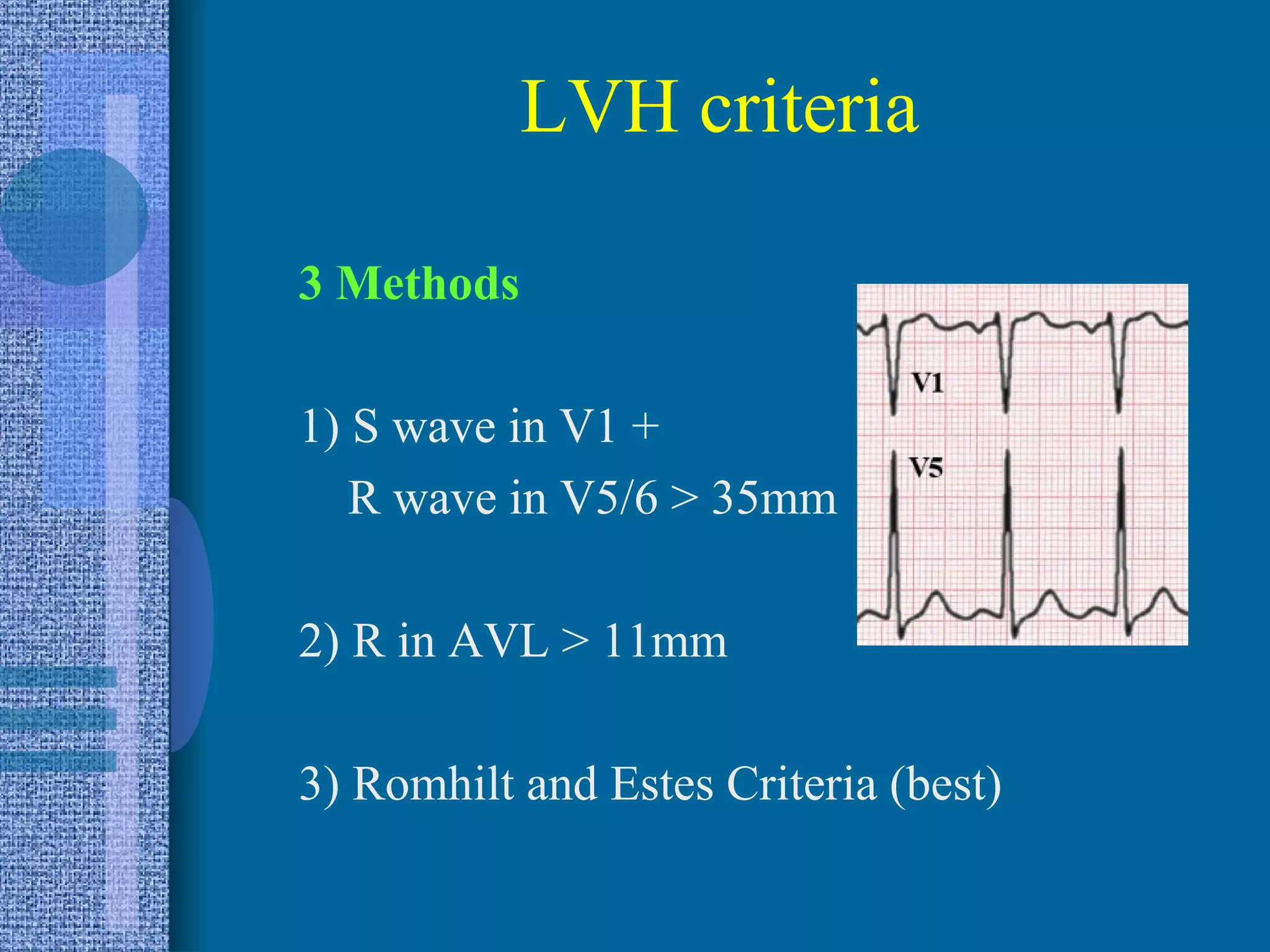 ELECTROCARDIOGRAM | PPT
