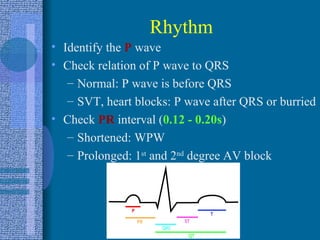 Rhythm Identify the  P  wave Check relation of P wave to QRS Normal: P wave is before QRS SVT, heart blocks: P wave after QRS or burried Check   PR  interval ( 0.12 - 0.20s ) Shortened: WPW Prolonged: 1 st  and 2 nd  degree AV block 