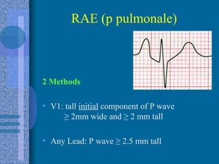 RAE (p pulmonale) 2 Methods V1: tall  initial  component of P wave  ≥  2mm wide and  ≥  2 mm tall Any Lead: P wave  ≥  2.5 mm tall 