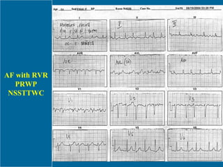 AF with RVR PRWP NSSTTWC 