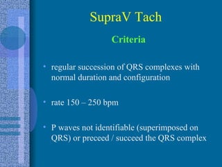 SupraV Tach Criteria regular succession of QRS complexes with normal duration and configuration rate 150 – 250 bpm P waves not identifiable (superimposed on QRS) or preceed / succeed the QRS complex 