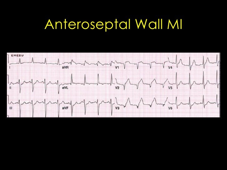 ELECTROCARDIOGRAM