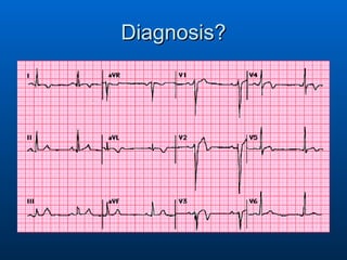 Diagnosis? 