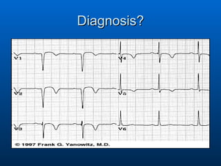 Diagnosis? 