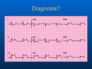 Diagnosis? 