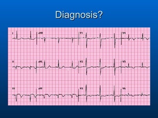 Diagnosis? 
