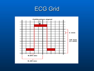 ECG Grid 