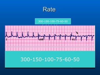 Rate  300-150-100-75-60-50 300-150-100-75-60-50 