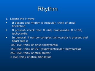 Rhythm 1.  Locate the P wave If absent and rhythm is irregular, think of atrial fibrillation. If present- check rate: If <60, bradycardia. If >100, tachycardia. In general, if narrow-complex tachycardia is present and heart rate is  100-150, think of sinus tachycardia 150-250, think of SVT (supraventricular tachycardia) 250-350, think of atrial flutter >350, think of atrial fibrillation 