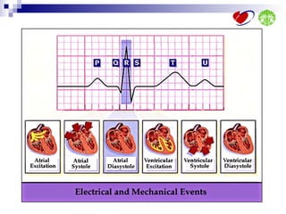 Ecg interpretation | PPT
