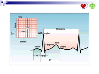 Ecg interpretation | PPT