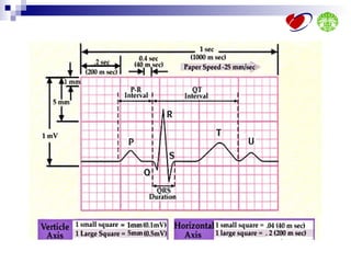 Ecg interpretation | PPT