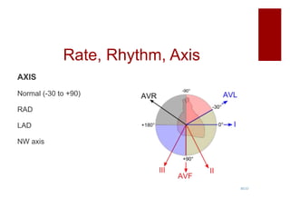 Rate, Rhythm, Axis
AXIS
Normal (-30 to +90)
RAD
LAD
NW axis
 