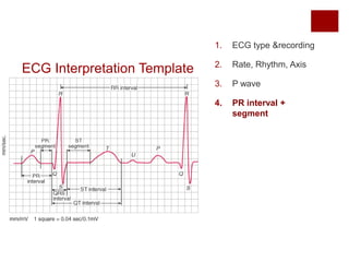 ECG Interpretation Template
1. ECG type &recording
2. Rate, Rhythm, Axis
3. P wave
4. PR interval +
segment
 
