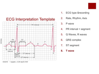 ECG Interpretation Template
1. ECG type &recording
2. Rate, Rhythm, Axis
3. P wave
4. PR interval + segment
5. Q Waves, R waves
6. QRS complex
7. ST segment
8. T wave
 