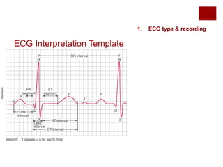 ECG Interpretation Template
1. ECG type & recording
 