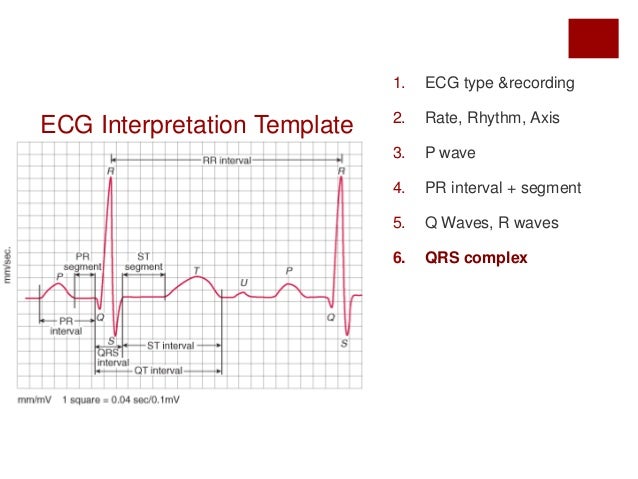 Systematic Ecg Interpretation