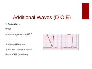 ECG interpretation | PPTX
