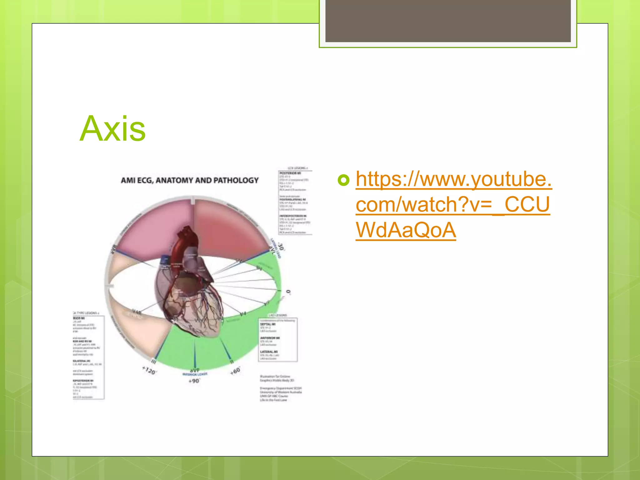 Axis
 https://www.youtube.
com/watch?v=_CCU
WdAaQoA
 