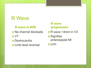 Ecg interpretation | PPTX