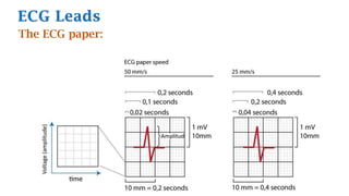ECG Leads
The ECG paper:
 