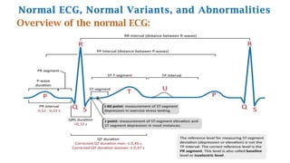 Normal ECG, Normal Variants, and Abnormalities
Overview of the normal ECG:
 