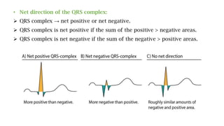 • Net direction of the QRS complex:
 QRS complex → net positive or net negative.
 QRS complex is net positive if the sum of the positive > negative areas.
 QRS complex is net negative if the sum of the negative > positive areas.
 