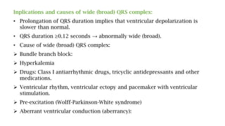 Inplications and causes of wide (broad) QRS complex:
• Prolongation of QRS duration implies that ventricular depolarization is
slower than normal.
• QRS duration ≥0.12 seconds → abnormally wide (broad).
• Cause of wide (broad) QRS complex:
 Bundle branch block:
 Hyperkalemia
 Drugs: Class I antiarrhythmic drugs, tricyclic antidepressants and other
medications.
 Ventricular rhythm, ventricular ectopy and pacemaker with ventricular
stimulation.
 Pre-excitation (Wolff-Parkinson-White syndrome)
 Aberrant ventricular conduction (aberrancy):
 