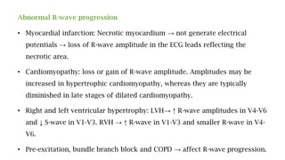 Abnormal R-wave progression
• Myocardial infarction: Necrotic myocardium → not generate electrical
potentials → loss of R-wave amplitude in the ECG leads reflecting the
necrotic area.
• Cardiomyopathy: loss or gain of R-wave amplitude. Amplitudes may be
increased in hypertrophic cardiomyopathy, whereas they are typically
diminished in late stages of dilated cardiomyopathy.
• Right and left ventricular hypertrophy: LVH→ ↑ R-wave amplitudes in V4-V6
and ↓ S-wave in V1-V3. RVH → ↑ R-wave in V1-V3 and smaller R-wave in V4-
V6.
• Pre-excitation, bundle branch block and COPD → affect R-wave progression.
 