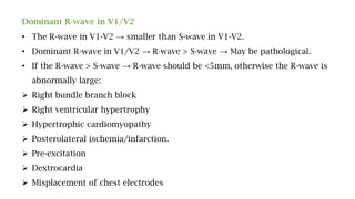 Dominant R-wave in V1/V2
• The R-wave in V1-V2 → smaller than S-wave in V1-V2.
• Dominant R-wave in V1/V2 → R-wave > S-wave → May be pathological.
• If the R-wave > S-wave → R-wave should be <5mm, otherwise the R-wave is
abnormally large:
 Right bundle branch block
 Right ventricular hypertrophy
 Hypertrophic cardiomyopathy
 Posterolateral ischemia/infarction.
 Pre-excitation
 Dextrocardia
 Misplacement of chest electrodes
 